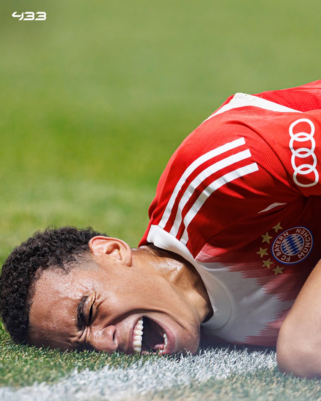 BREAKING: Jamal Musiala Suffers Horror Injury Against PSG, Ruled Out for 4–5 Months