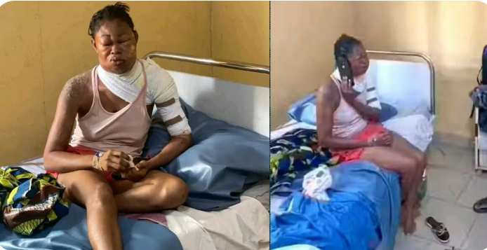 Chaos on Campus: Abia State University Student Hospitalized After Brutal Hot Water Attack by Fellow Student